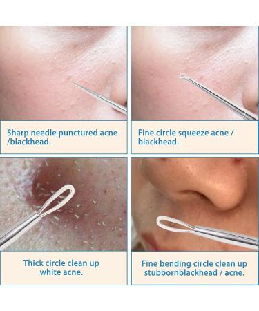 Professional Blackhead and Whitehead Extractor Tool Kit - 5 Pcs/Set for Face and Nose - Stainless Steel Pimple Popper Set VT921A - Buy Online on SooperMarket.com