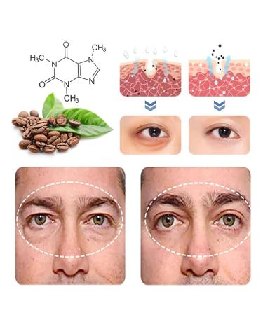 Klarime Open Eyes Awaken Peptide Lifting Eye Gel - Reduces Puffiness, Dark Circles, Under Eye Bags, and Wrinkles - 1pcs - Buy Online on SooperMarket.com