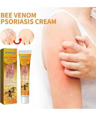Bee Venom Cream for Psoriasis Cream Bee Venom Cream Psoriasis Treatment New Zealand Bee Venom Chinese Herbal Cream for Psoriasis Bee Venom Psoriasis Soothing Itching 20g (2) - Buy Online on SooperMarket.com