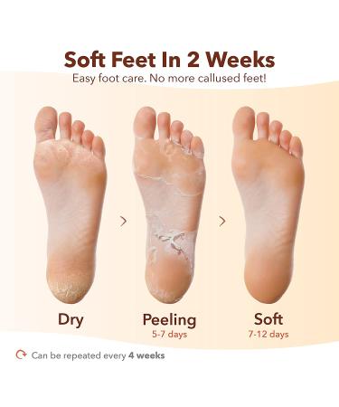 PUREDERM Exfoliating Foot Mask 3 Pack - Vegan Foot Peel for Soft, Cracked Heels with Papaya & Citrus Extracts - Buy Online on SooperMarket.com