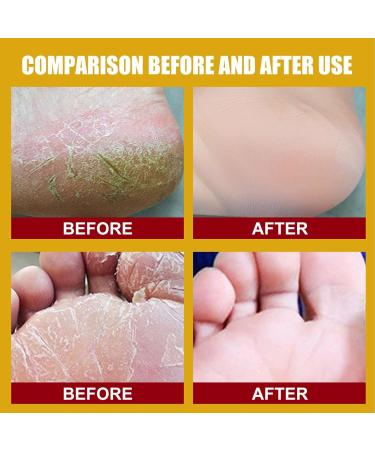 Foot Care Moisturizing Cream - Regenerating Formula for Cracked Feet - Fast Absorbing & Intensive Hydration - 1g Pack (Yellow) - Buy Online on SooperMarket.com