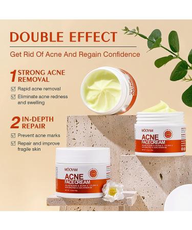 Salicylic Acid Acne Treatment Cream for Face & Body - Teens & Adults | Anti-Acne Moisturizer & Spot Treatment - Buy Online on SooperMarket.com