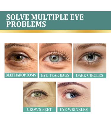 2PC Jasmine Ointment for Dark Circles - Anti-Aging Eye Cream with Collagen & Aloe Vera | Remove Puffiness & Bags - Buy Online on SooperMarket.com