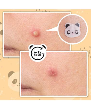 AUSLKA Panda Pimple Patches 120 Count - Hydrocolloid Spot Dots for Face Acne Absorbing Cover Patch - Blemishes and Pimple Stickers for Clear Skin - Pack of 1 - Buy Online on SooperMarket.com