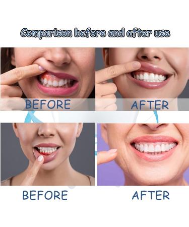 VEROA Tooth Gum Pain Relief Spray - Real Time Toothache Gum Pain Relief for Adult Relieve Gum Swelling Natural Toothache Relief Strong Mouth Spray - for Gum Disease Treatment for Adults - 20ML - Buy Online on SooperMarket.com
