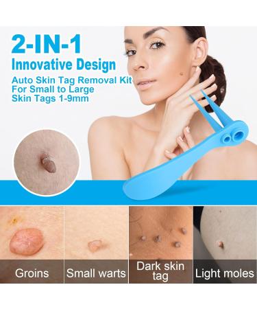 Painless 2-in-1 Skin Tag Removal Kit for Micro to Large Skin Tags (1-9mm) - Safe & Easy DIY Tool for Home Use - Buy Online on SooperMarket.com