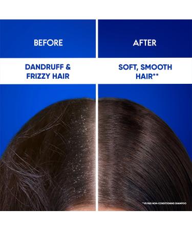 Buy Head & Shoulders Smooth and Silky 2-in-1 Anti Dandruff Shampoo + Conditioner 180ml | International Shipping Available - Buy Online on SooperMarket.com