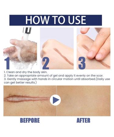 Pregnancy Scar Gel - Moisturizing & Rejuvenating Skincare Must-Have for First Trimester - Dark Blue - Buy Online on SooperMarket.com