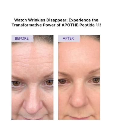 Peptide 11 Botulinum Tension Up Repair Cream 50ml | Anti-Aging Skincare | International Shipping Available - Buy Online on SooperMarket.com