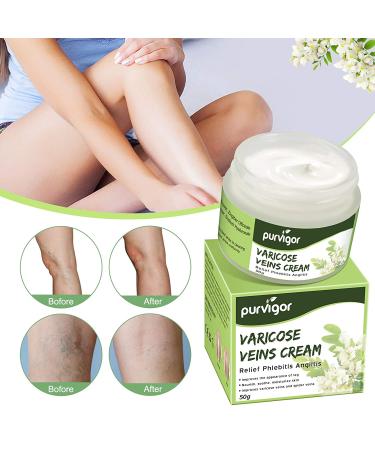 Purvigor Varicose Vein Cream - Eliminate Spider Veins & Phlebitis Angiitis on Leg, Body & Arms - Buy Online on SooperMarket.com