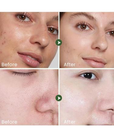 Teksome Face Moisturizer Toner Skin Toning Lotion Reduce Fine Lines | Hydrating Skincare Products with Refreshing and Brightening Essence - Buy Online on SooperMarket.com