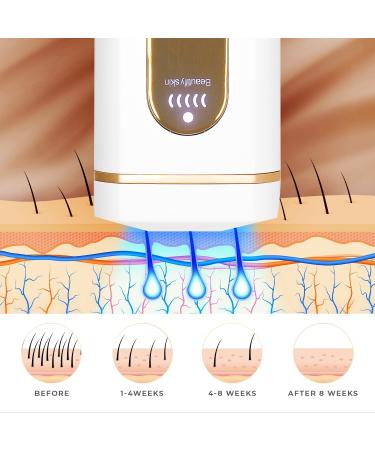 Edicare Laser Epilator IPL | Hair Removal for Women & Men | 4 Modes & 5 Intensities | Home Use Face Body & Bikini - Buy Online on SooperMarket.com