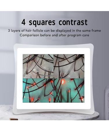 Skin Diagnosis Hair Analyzer 17 Inch 50X 200X Magnification LCD Screen Scalp Hair Follicle Hair Skin Analyser Machine 3 Light Modes Hair Follicle Detector for Home Salon Use - Buy Online on SooperMarket.com