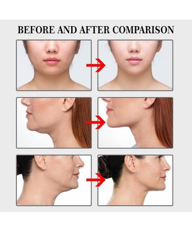 100PCS Invisible Face Tape - Waterproof Facial Lifting Tape for Wrinkles Removal & Double Chin Achieve a Slim & Firm Face - Buy Online on SooperMarket.com