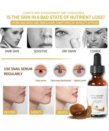 Snail Intensive Repair Serum Snail Mucin Essence Anti Wrinkle Collagen Serum Lifting & Anti Wrinkle Hydrating Face Serum Anti-aging Serum for Woman/Man Reduce Fine Lines Moisturiser - Buy Online on SooperMarket.com