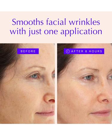 Face & Forehead Wrinkle Patches - Anti Wrinkle Tape for Eye, Mouth, Forehead - Reduce Fine Lines Overnight - Botox Alternative (160 ct) - Buy Online on SooperMarket.com