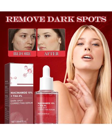 KERANEET Niacinamide Serum Face Serum Niacinamide Serum Face Serum Moisturising Serum Face Serum Suitable for Use Day and Night - Buy Online on SooperMarket.com
