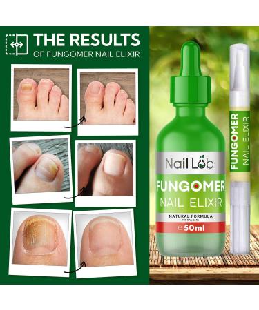 NAIL LAB Premium Fungal Nail Treatment 50ml - Tea Tree Oil for Toenails & Fingernails - Includes Bonus Nail Fungal Pen & File - Buy Online on SooperMarket.com
