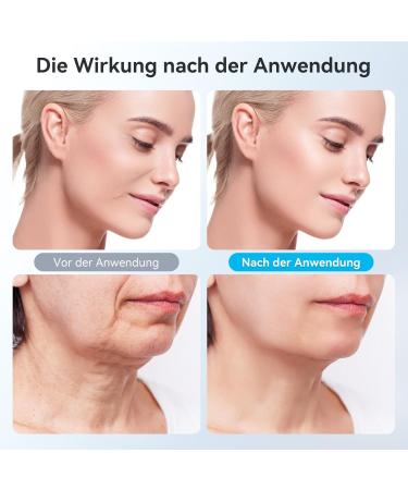 Carer Spark 4-in-1 Facial Massage Device - Anti-Aging RF EMS & LED Technology for Wrinkle Reduction & Skin Tightening - Buy Online on SooperMarket.com