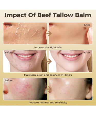 Premium Beef Tallow Balm for Skin Repair | Grass Fed Moisturizer - 4 oz Bergamot Lavender - Buy Online on SooperMarket.com