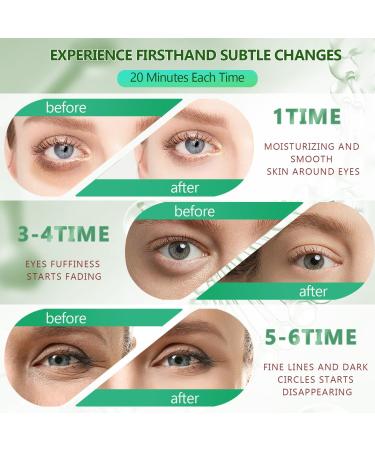Green Gold Collagen Under Eye Mask (60 Pcs) - Hydrating Gel Pads for Dark Circles, Puffiness & Wrinkles - 30 Pairs Under Eye Patches for Men & Women - Beauty Skin Care Treatment - Buy Online on SooperMarket.com