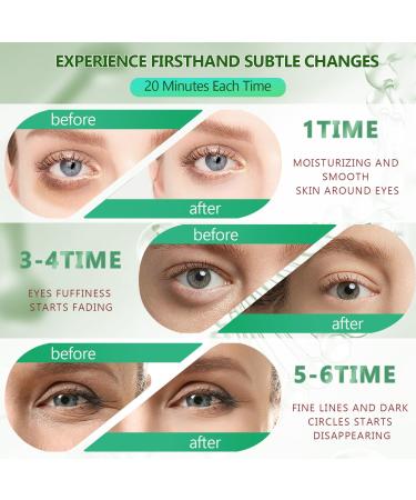 60 PCs Hydration Eye Pad Mask - 30 Pairs Anti-Aging Collagen Hydrogel with 24K Gold & Hyaluronic Acid - Remove Dark Circles | International Shipping - Buy Online on SooperMarket.com