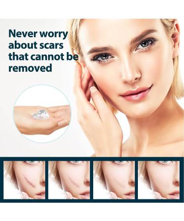 Stretch Marks & Scar Gel 50ml - Safe Vitamin E Formula for Effective Removal - Buy Online on SooperMarket.com