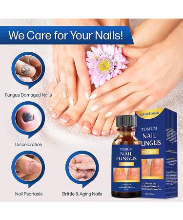 Extra Strength Toe Nail Fungus Treatment for Healthy Nails - Nail Repair Solution - Buy Online on SooperMarket.com