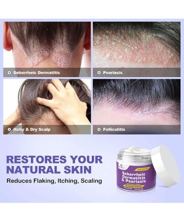 Dr. DERM Seborrheic Dermatitis Cream - Psoriasis Scalp Treatment for Folliculitis, Dry Scalp & Dandruff - Anti-Itch & Soothing Relief - 3.4 Fl Oz - Buy Online on SooperMarket.com