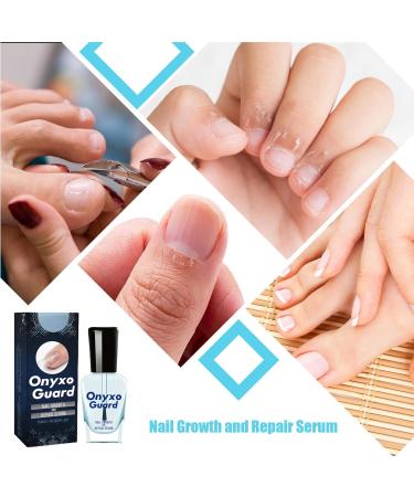  1/2/3/4/5/6 Nail Conditioner for Damaged Nails Nail Strengthener for Weak Nails Onyxoguard Nail Growth and Repair Serums Essence Nail Hardener Extra Strong and Growth Nail Guards for Strength - Buy Online on SooperMarket.com
