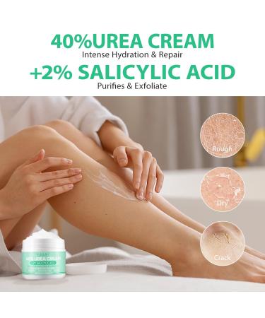 Urea Cream 40% with 2% Salicylic Acid - Best Callus Remover & Foot Repair Lotion for Dry Cracked Heels Knees & Hands (5.29 OZ) - Deep Moisturization & Skin Renewal - International Shipping Available - Buy Online on SooperMarket.com