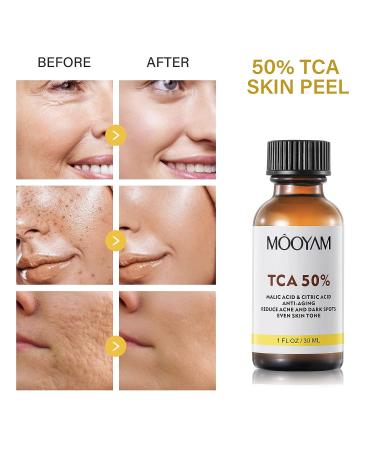 50% Citric Acid Peeling Serum for Face | Skin Peel Solution for Dark Spots & Acne | Exfoliating Chemical Peel 30ml - Buy Online on SooperMarket.com
