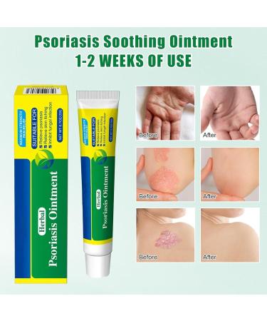 Neyeau Natural Organic Chinese Herbal Cream Skin Cream Soothing Ointment Dermatitis Cream - Relieve Itching for Dry Skin Rough Skin Peeling Moisturizing Skincare External Use - Buy Online on SooperMarket.com