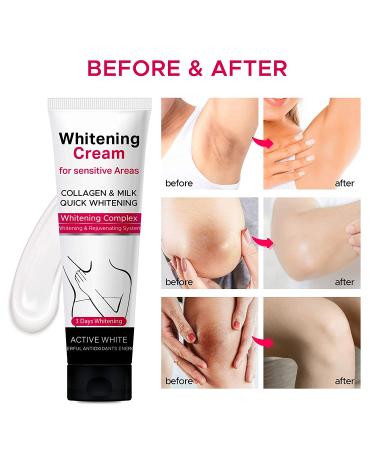 Venanoci Dark Spot Corrector Cream: Instant Results for Armpit, Knees, Elbows, & Private Areas - with Hyaluronic Acid & Mulberry Extract - Buy Online on SooperMarket.com