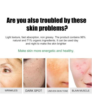 Dark Spot Remover for Face & Body Dark Spot Corrector Cream Age Spot Remover for Face Spot Cream Dark Spot Corrector Freckle Remover Cream Dark Spot Correcting Glow Serum Dark Spots Remover 20 g - Buy Online on SooperMarket.com