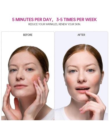 USUIE 4 in 1 Facial Device | Red Light Therapy for Face and Neck | Reduce Wrinkles | Anti-Aging Tools - Buy Online on SooperMarket.com