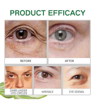 Aloe Vera Eye Cream Aloe Vera Under Eye Cream Eye Cream Anti Aging Eye Cream for Dark Circles and Puffy Eyes Eye Bags Remover Dark Eyes Circle Treatment Reduce Fine Lines Moisturising Soothing - Buy Online on SooperMarket.com