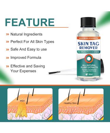 Skin-Tag-Remover Kit Remover for Verruca-Treatment - 30ml - Buy Online on SooperMarket.com