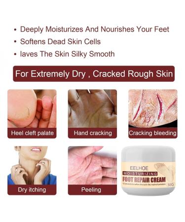 Moisturizing Foot Cream with Avocado Oil | Repair & Care for Soft Smooth Feet - Buy Online on SooperMarket.com