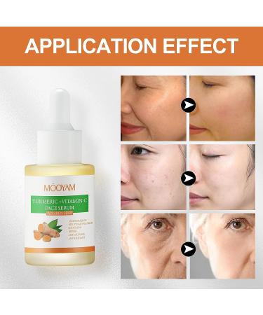 Turmeric Dark Spot Corrector Serum with Vitamin C - 30ml/1oz - Acne & Hyperpigmentation Treatment to Smooth Skin - Buy Online on SooperMarket.com