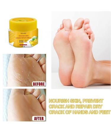 Foot Care Moisturizing Cream - Regenerating Formula for Cracked Feet - Fast Absorbing & Intensive Hydration - 1g Pack (Yellow) - Buy Online on SooperMarket.com