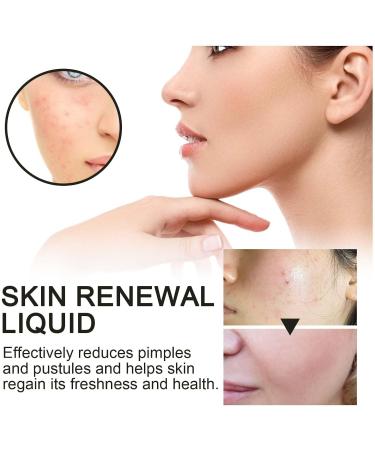 GeRRiT Poreclear 2% BHA Skin Fluid Facial Skin Refining Serum Skin Liquid Facial Exfoliator Facial Exfoliating Serum 1pcs - Buy Online on SooperMarket.com