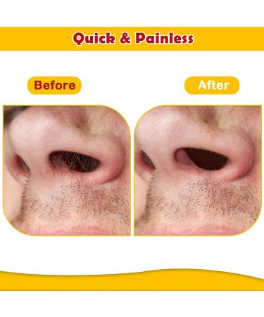 Nose Hair Wax Kit - 120g Wax with 40 Applicators & 20 Wipes - Painless Hair Removal for Men and Women - Buy Online on SooperMarket.com
