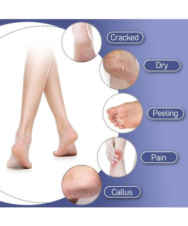 Wllhyf Ventilated Moisturizing Gel Socks - Soft Open-Toe Spa Socks for Foot Care & Treatment | Hydrate Dry Cracked Feet - Buy Online on SooperMarket.com