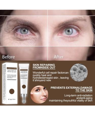 2pcs Silk Protein Anti-Aging Eye Cream for Wrinkles, Dark Circles, Fine Lines - Firming & Repair Eye Serum - Buy Online on SooperMarket.com