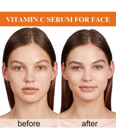 Vitamin C Serum with Collagen Vitamin C Serum for Face Vitamin C Serum Natural Anti Aging & Wrinkle Facial Serum Vitamin C Collagen Serum Brightening Serum Improve Dull Tired Skin 50ml - Buy Online on SooperMarket.com