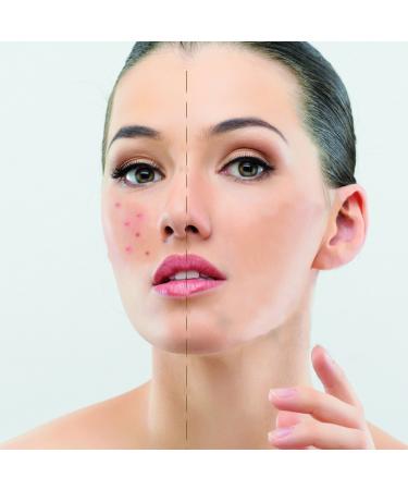 Ikos Dermaprof - Professional Make-Up Finish 30ml | International Shipping Available - Buy Online on SooperMarket.com