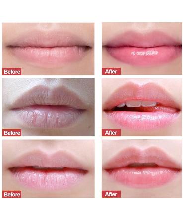 Natural Lip Peeling & Scrub Cream | Nourishing Dead Skin Removal & Intensive Repair Treatment (20g) - Shop Internationally - Buy Online on SooperMarket.com