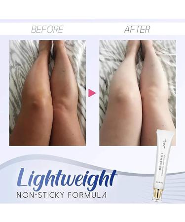 SnowySkin Legs Underarm Cream & Nose Strips Set - Instant Personal Skin Care | White | One Size - Buy Online on SooperMarket.com