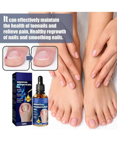 German Toenailcare Removal Paronychia Oil - Repair Damaged Discolored Thick Nails - 2 Pcs - Buy Online on SooperMarket.com